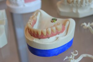 bottom dentures