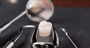 Veneers Urbn Dental
