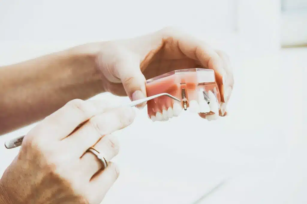 Dental Implant Surgery
