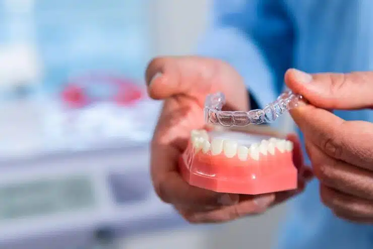Invisalign Clear Aligners