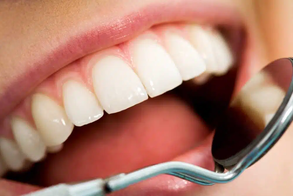 Teeth Whitening Dentist