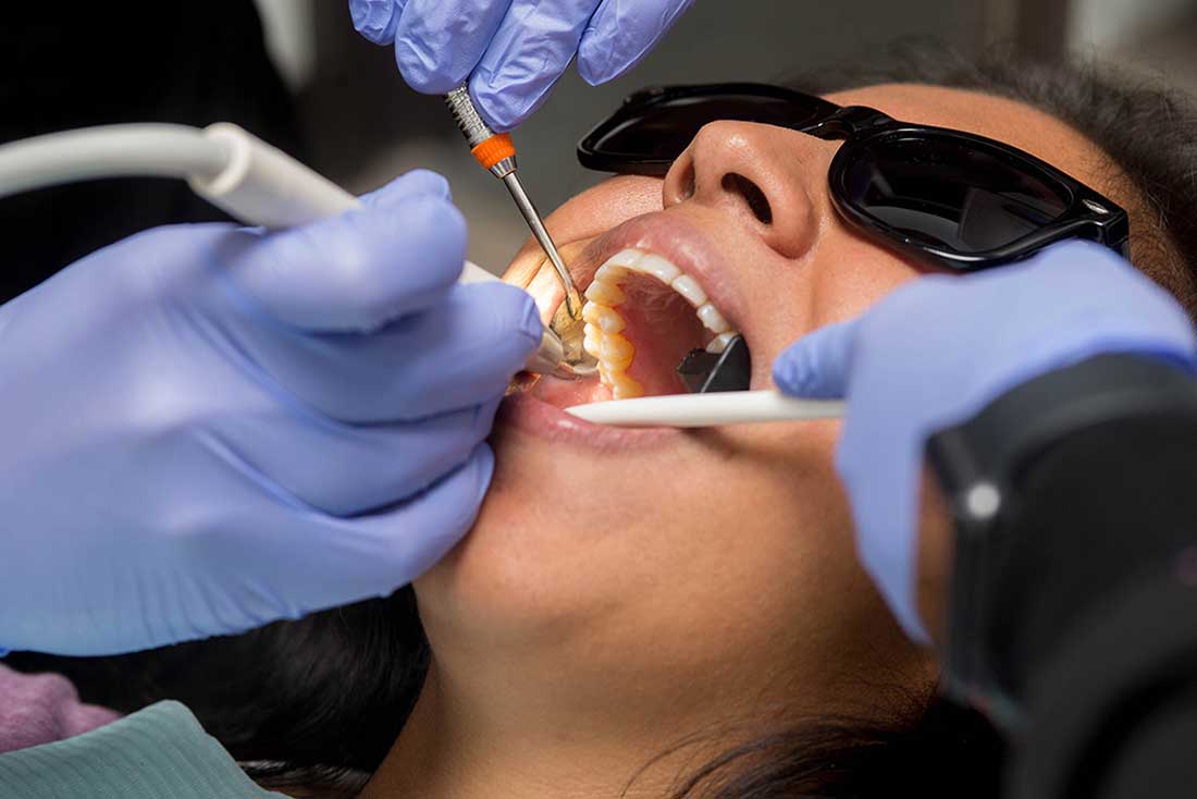 Dental Bone Graft And Ridge Preservation Treatment