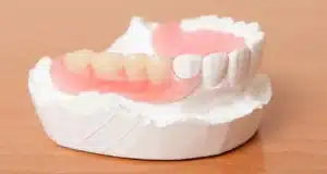 Dentures