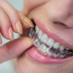 Invisalign Dentist