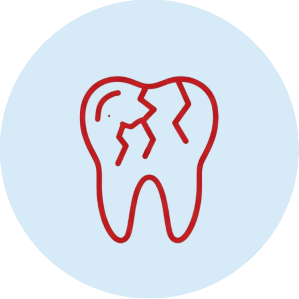 Cracked teeth