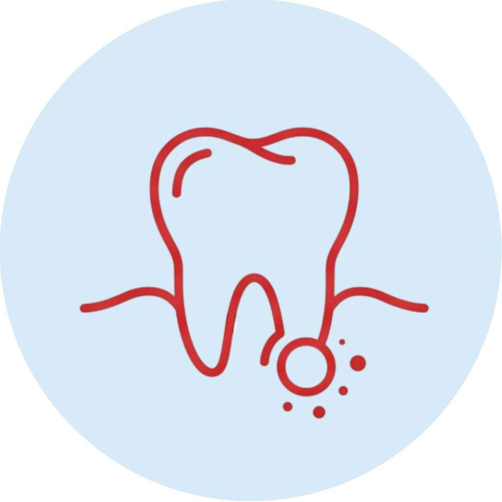 Dental abscesses and infections