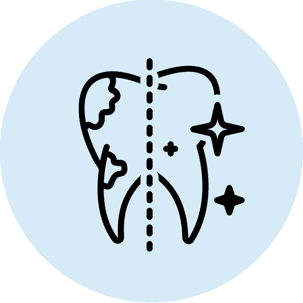 Invisalign® Clear Aligners